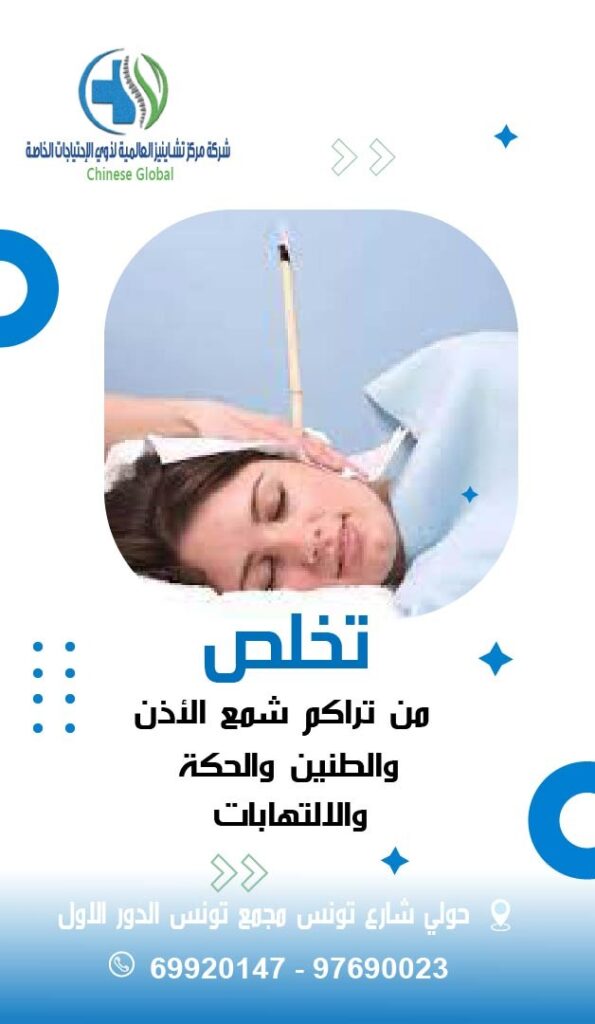 شمع الأذن صملاخ